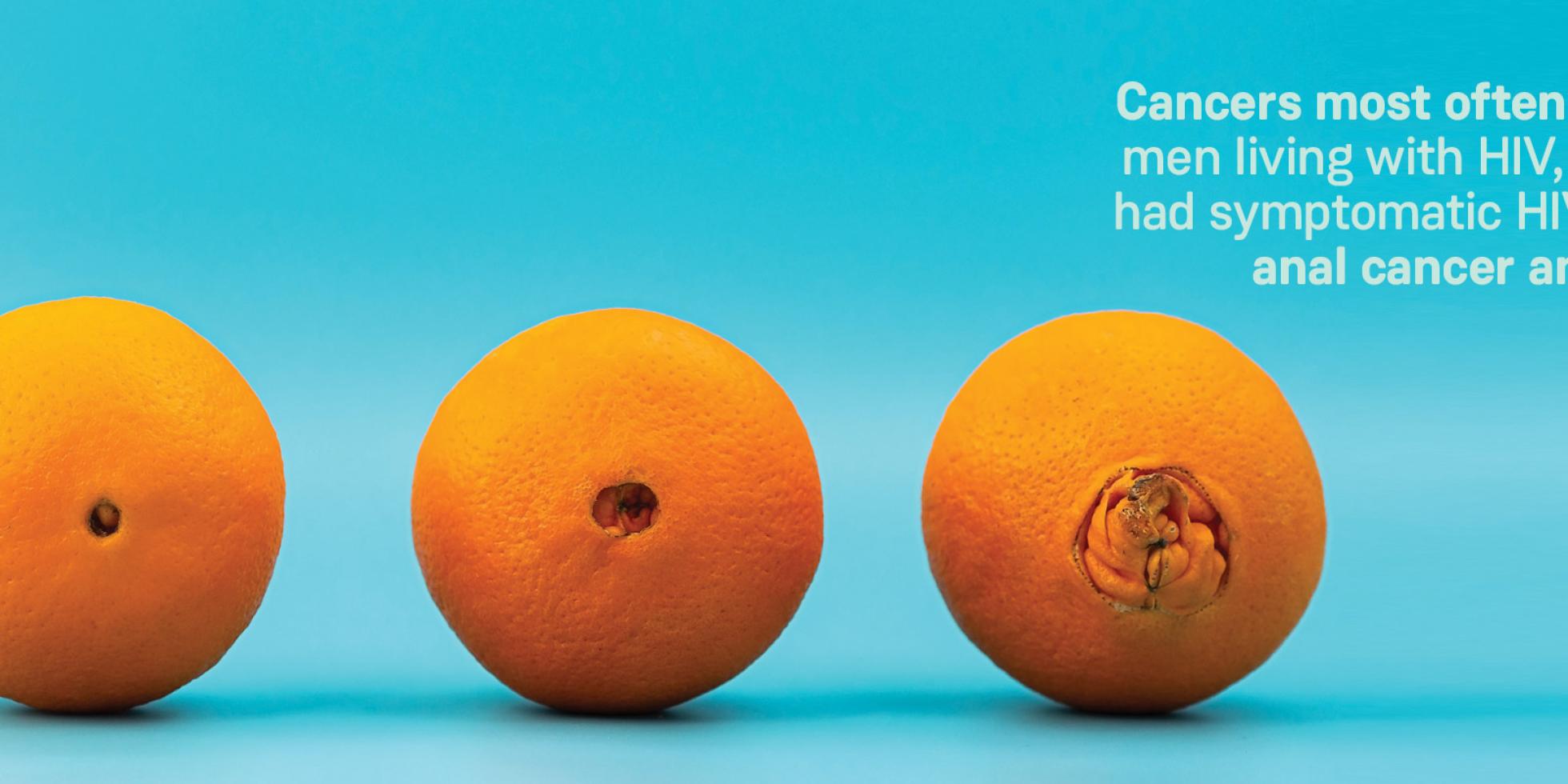 three navel oranges with an increasingly large, prominent navel